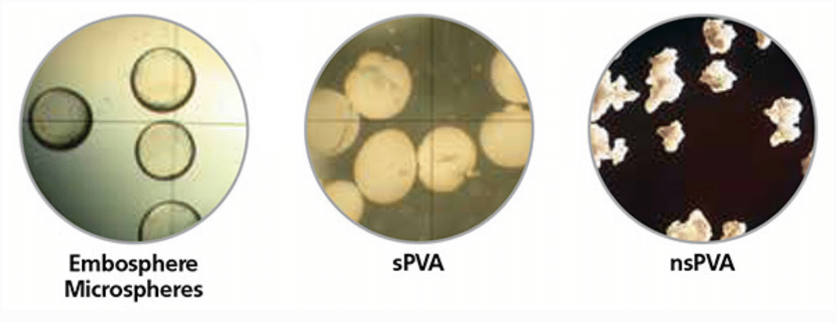Embosphere Microspheres show clearer cross-section than sPVA or nsPVA