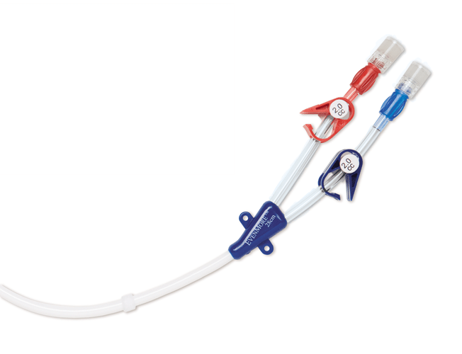 Image of the EvenMore Chronic Hemodialysis Catheter, showing the two lumens in red and blue